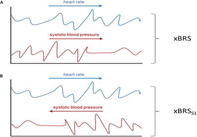 Instantaneous Cardiac Baroreflex Sensitivity: xBRS Method Quantifies Heart Rate Blood Pressure Variability Ratio at Rest and During Slow Breathing